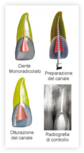 Terapia canalare